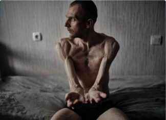 UN Condemns Abuse of Ukrainian Prisoners by Russians un-condemns-abuse-of-ukrainian-prisoners-by-russians